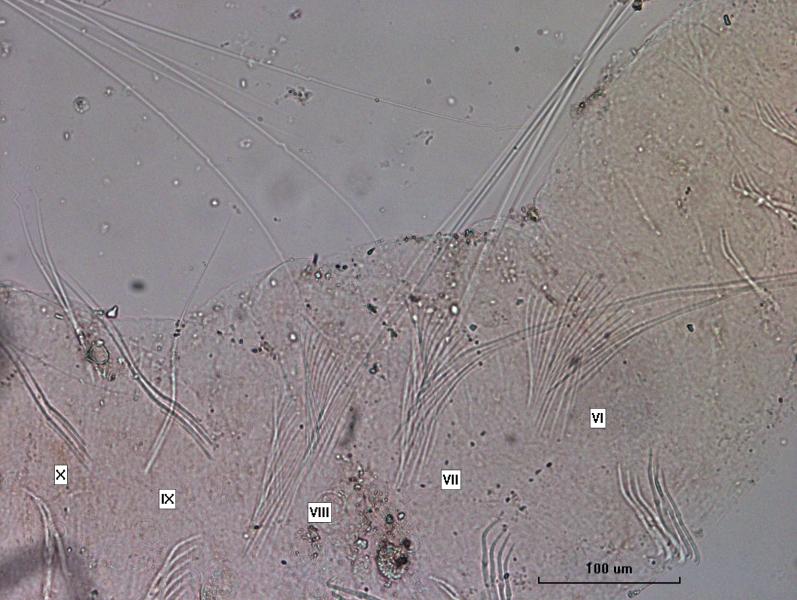photomicrograph of part of an oligochaete worm with segments VI through X labeled. VI-VIII have a mixture of a few very long hairs with many short needles, while IX and X have shorter hairs with shorter needles.