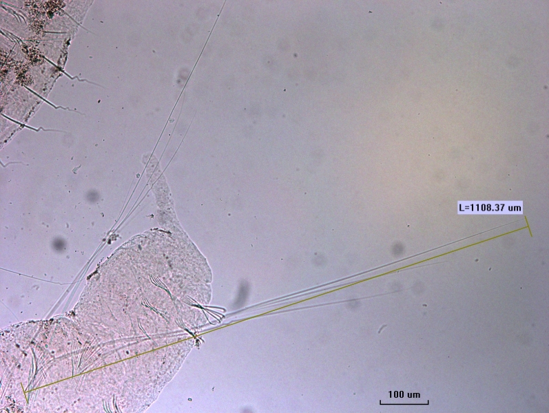 photomicrograph of a worm with a proboscis and very long hairs. Some hairs measure 1108.37 um.