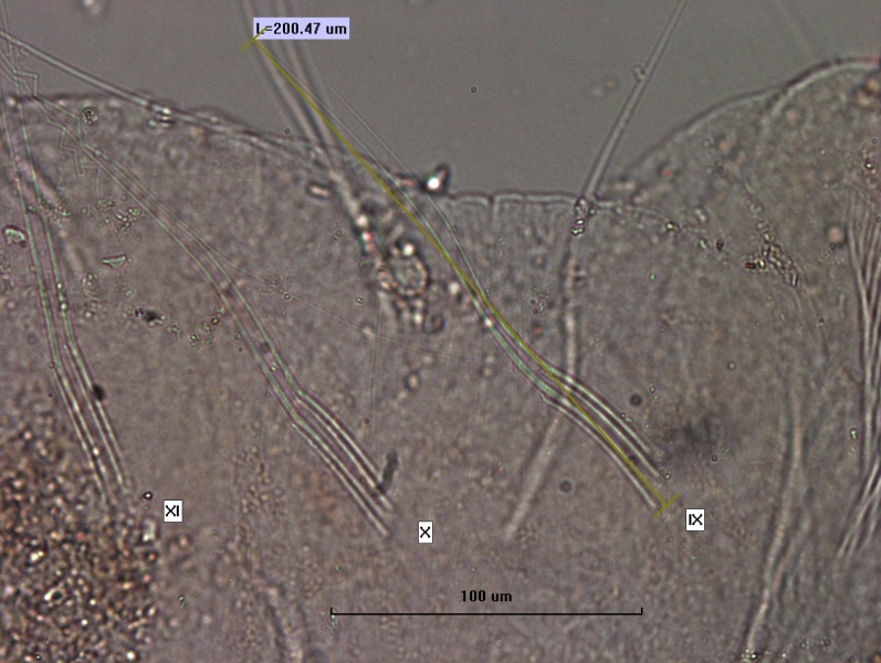 photomicrograph of the hair chaetae of a worm in segments IX, X, and XI. The hairs measure 200.47 um.