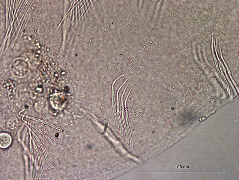 photomicrograph of part of an oligochaete worm showing bundles of bifid chaetae with the upper tooth shorter and thinner than the lower.