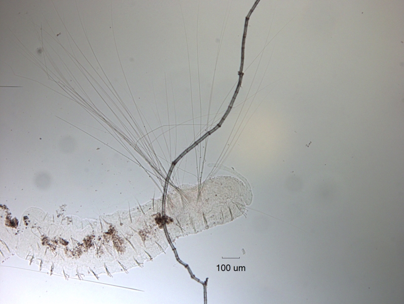 photomicrograph of a worm with a proboscis and giant hairs near the front, but smaller hairs farther back.