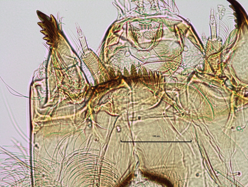photomicrograph of the head capsule of a chironomid midge larva showing the mentum (4 median teeth and 6 lateral teeth on either side) and broad ventromental plates in line with the edge of the outer median teeth