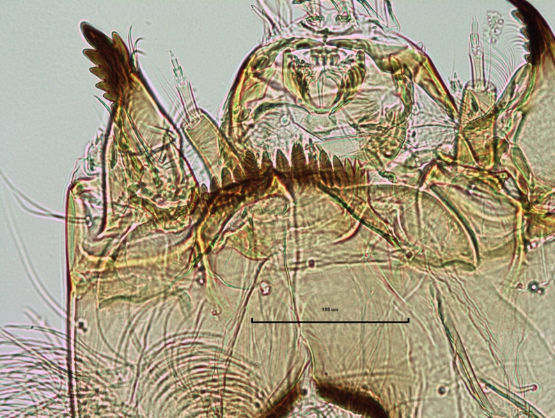 photomicrograph of the head capsule of a chironomid midge larva showing the mandibles with 4 inner teeth in addition to the long one on the end and a small tooth on top of the longest tooth. The antenna has 5 segments and the antennal blade is as long as the last 4 segments.