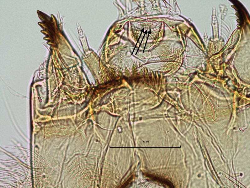 photomicrograph of the head capsule of a chironomid midge larva showing the pecten epipharyngis, which is made of three plates that each have a few very long serrations that look like fused teeth. Arrows point to the three plates.
