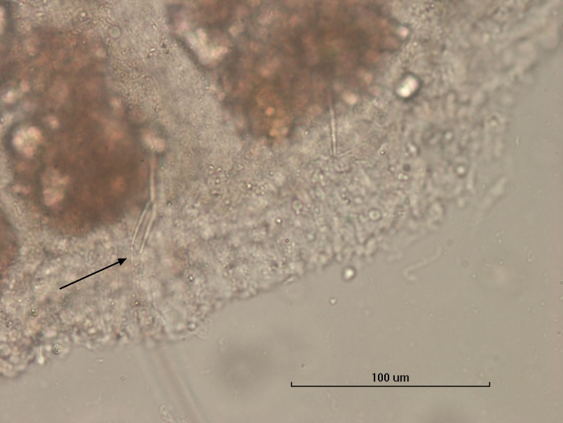 Photomicrograph of the body of an oligochaete worm showing  bundles of somatic hairs (chaetae). There is foreign matter attached to the body. The chaetae are short and have very thin ends. Scale bar 100 µm.