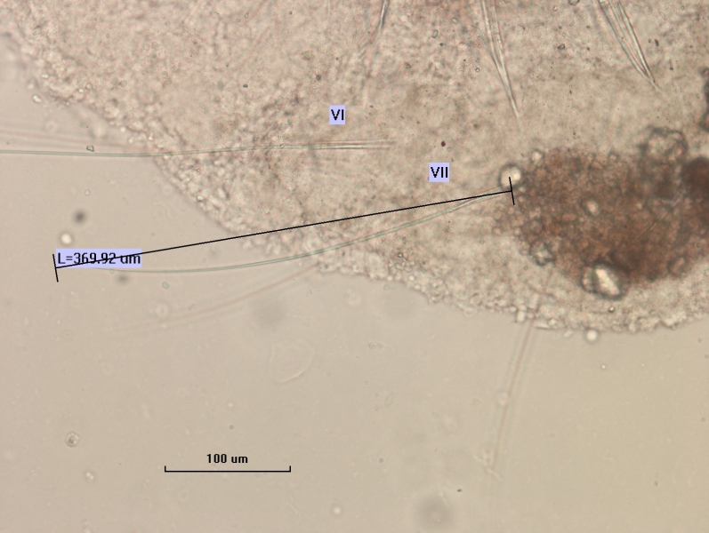 Photomicrograph of the body of an oligochaete worm showing  bundles of somatic hairs (chaetae). There is foreign matter attached to the body. Two bundles of hair are labeled VI and VII, the latter measures L=369.92 µm. Scale bar 100 µm.