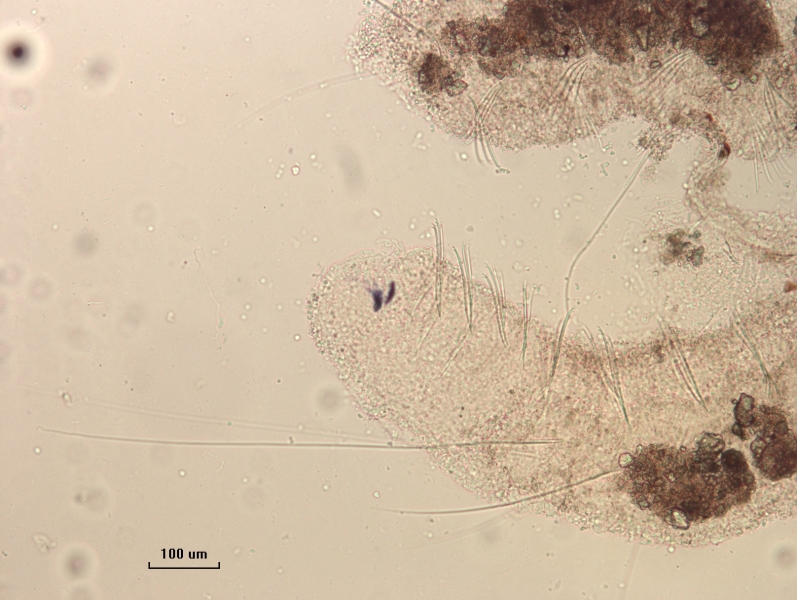 Photomicrograph of the head of an oligochaete worm showing two eyespots and two rows of bundles of somatic hairs (chaetae). There is foreign matter attached to the body. The first set of hairs are very long.