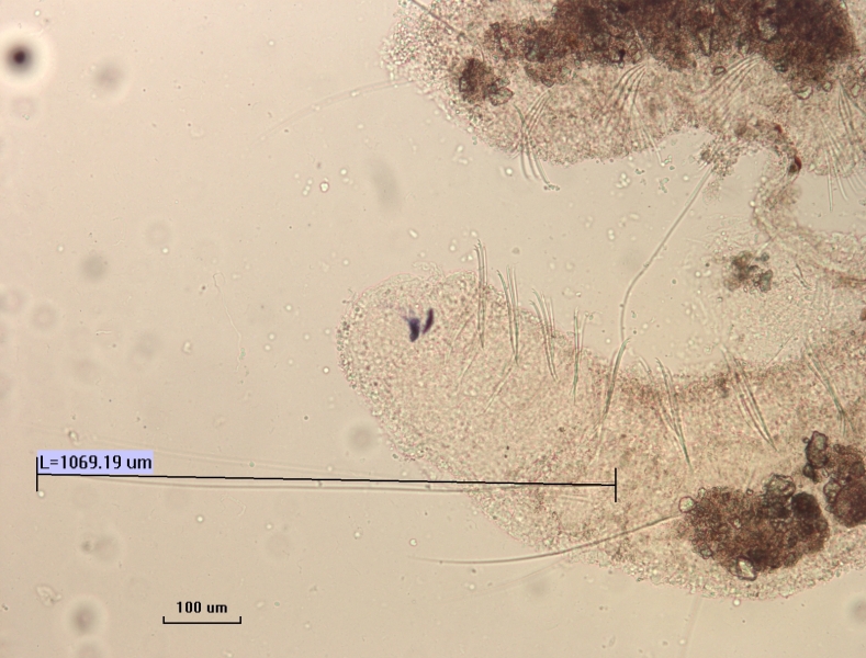 Photomicrograph of the head of an oligochaete worm showing two eyespots and two rows of bundles of somatic hairs (chaetae). There is foreign matter attached to the body. The first set of hairs are very long, measured L=1069.19 µm. Scale bar 100 µm.