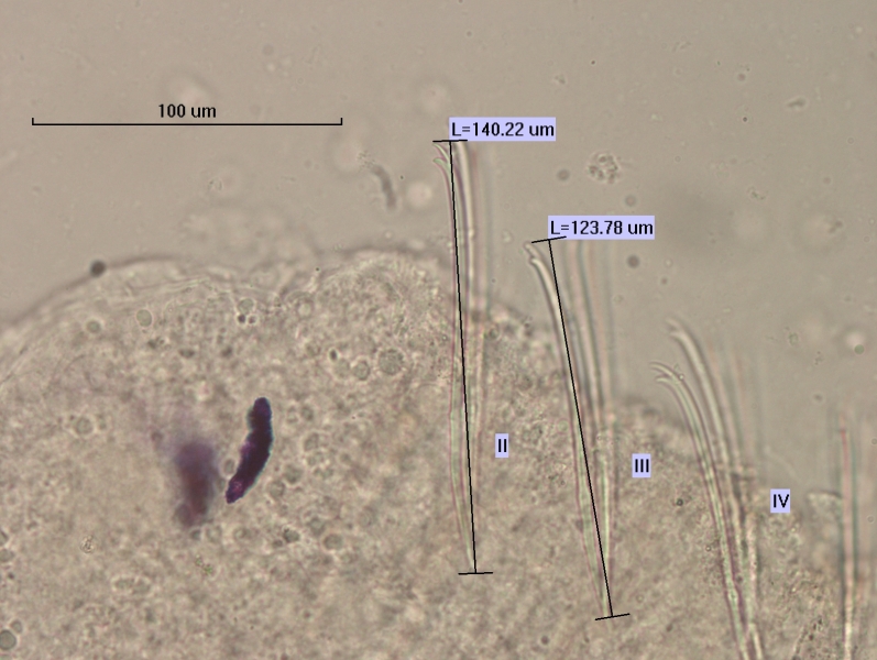 Photomicrograph of the head of an oligochaete worm showing two eyespots and two rows of bundles of somatic hairs (chaetae). The chaetae have two teeth. The chaetae labeled II measure 140.22 µm and those in III are 123.78 µm. Scale bar 100 µm.