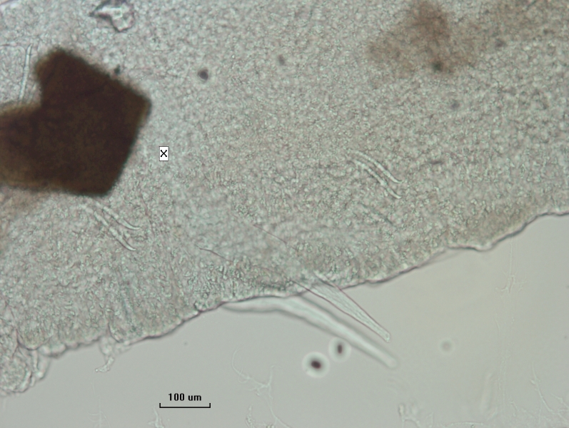 photomicrograph of worm reproductive structure (penes) protruding from the body of the worm and tapering to a point