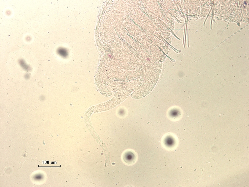 Photomicrograph of the head of an oligochaete worm with a proboscis with two lobes on either side, and eyespots