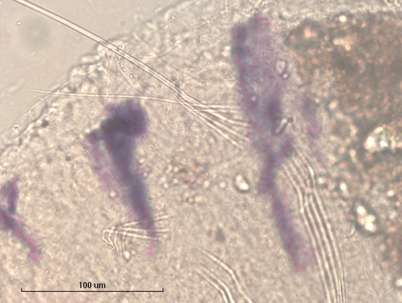 Photomicrograph of part of an oligochaete worm showing the dorsal hair and needle chaetae (somatic hairs). The needles are short and simple-pointed and their points join together into a tent.