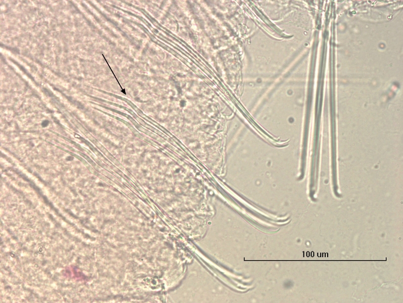 Photomicrograph of the somatic hairs (chaetae) of an oligochaete worm. The bottom of the chaetae have two angular bends