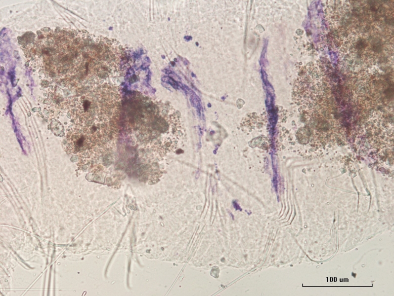 Photomicrograph of the body of an oligochaete worm with bands of pigment visible.