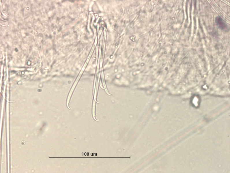 Photomicrograph of the somatic hairs (chaetae) of an oligochaete worm. The upper tooth of the chaetae is longer and curved, and the lower is very short.