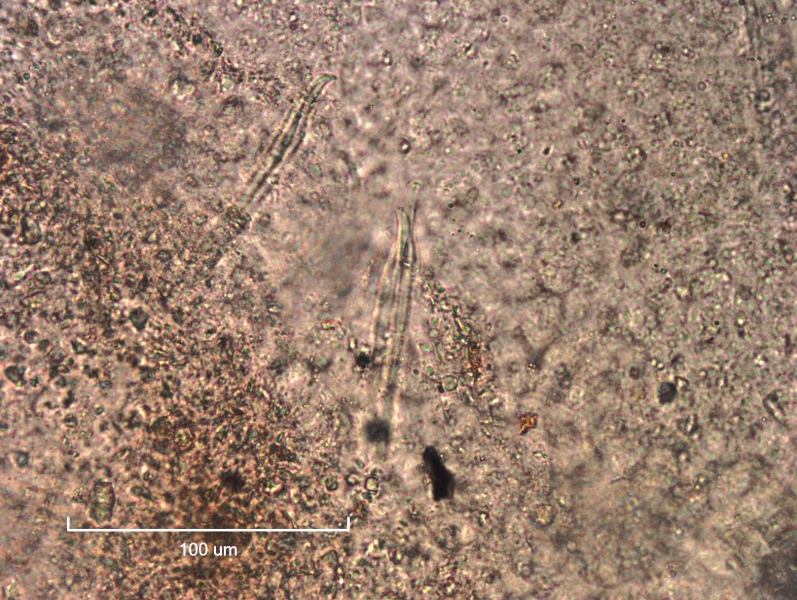 Photomicrograph of the reproductive hairs (penial chaetae) of an oligochaete worm. There are two bundles of a few simple-pointed chaetae with slightly curved ends.