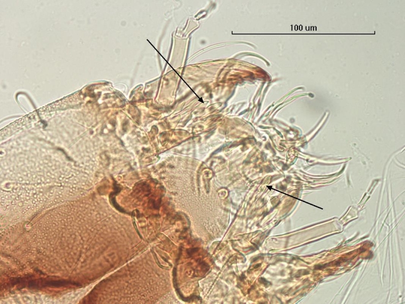 Photomicrograph showing the dorsal surface of the head capsule of a chironomid midge larva. The antennae have at least 4 segments, and at the base of the antennae are winglike projections with arrows pointing to them. The head capsule is granulated.