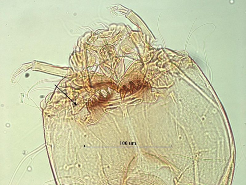 Photomicrograph of the head capsule of a chironomid midge larva showing the mentum and ventromental plates. The central tooth of the mentum is large but lighter than the lateral teeth, making it a little harder to see. The ventromental plates are very wide and striated with an arrow pointing to one. The mandibles are folded right above the mentum and have a large end tooth and two smaller pointed inner teeth.