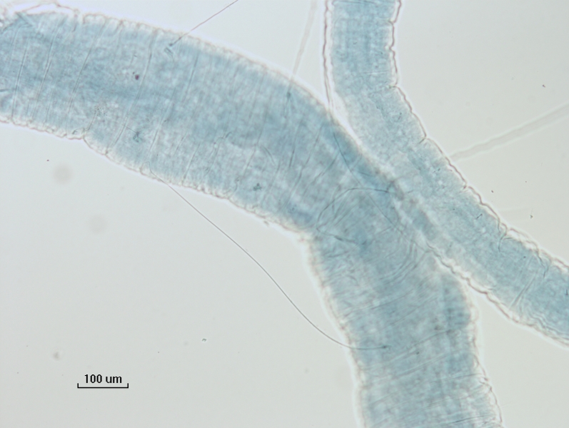 photomicrograph of two parts of an oligochaete worm with a long thin body and some extremely long single hairs. Many of the accompanying crochet chaetae are broken are missing, and the body seems wrinkly 
