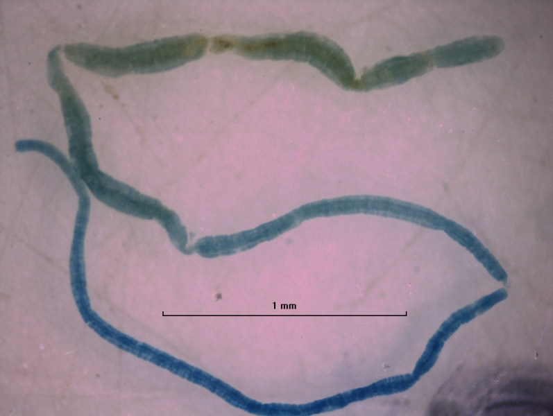 photomicrograph of the whole body of an extremely long and thin oligochaete worm, 1 mm scale bar, worm is about 7 mm long