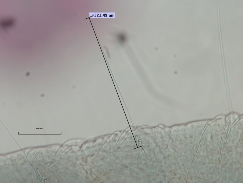 photomicrograph of part of an oligochaete worm showing a hair chaetae measuring 323.49 um with a couple broken crochet chaetae, the skin is wrinkled
