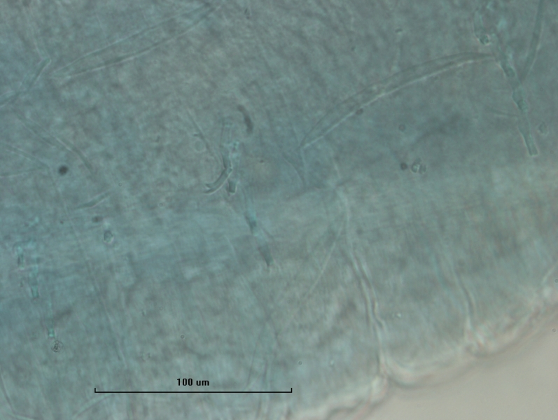 photomicrograph of part of an oligochaete worm showing a bifid chaetae with the upper tooth a little longer and thinner than the lower in a bundle with a few other broken chaetae. The skin is wrinkled.
