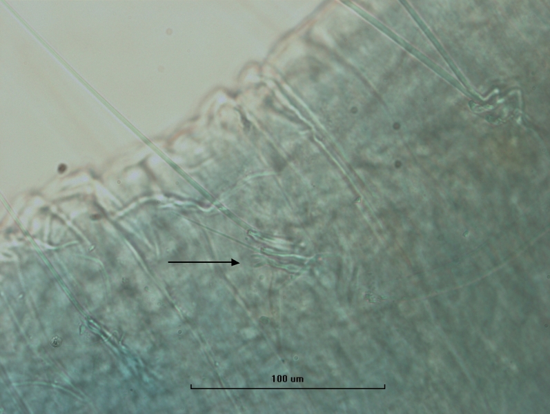 photomicrograph of part of an oligochaete worm showing a bundle with two hairs, two broken crochet chaetae, and an arrow pointing to a third pectinate chaetae that is U-shaped with a few thin intermediate teeth, skin is wrinkled, scale bar 100 um