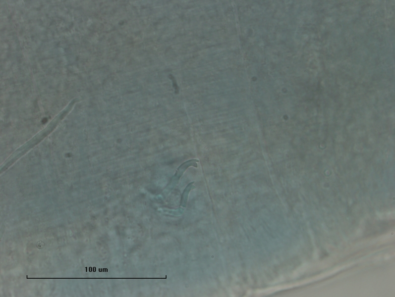 photomicrograph of part of an oligochaete worm showing a bundle of two bifid chaetae with the upper tooth shorter than the lower, scale bar 100 um
