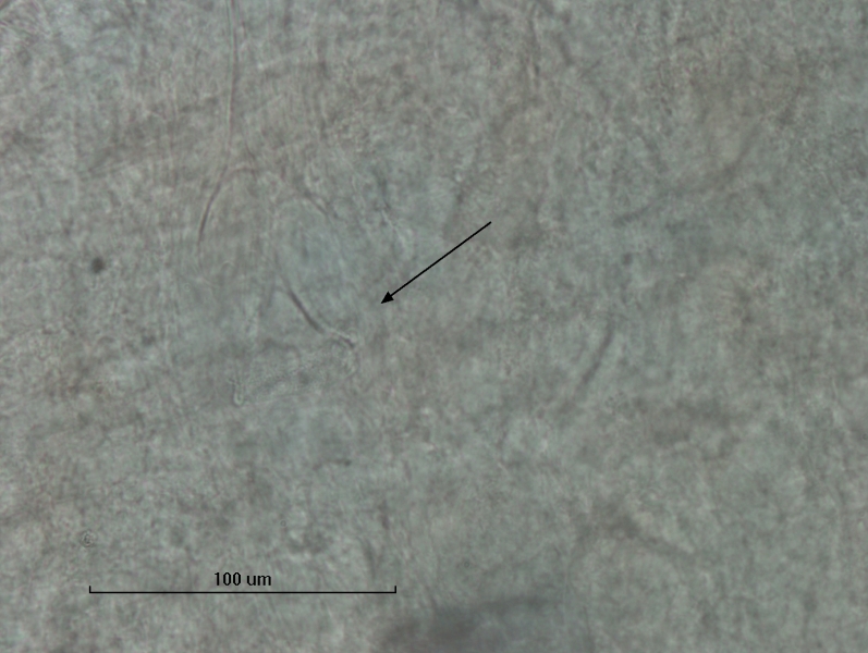photomicrograph of part of an oligochaete worm with an arrow pointing to a reproductive structure, small tub-shaped with granular texture, scale bar 100 um