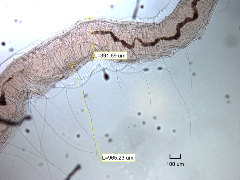 photomicrograph of part of a long, thin oligochaete worm with extremely long hairs, body width is 391.69 um and one hair measures 965.23 um, a small scale bar 100 um