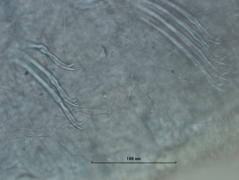 photomicrograph of part of an oligochaete worm showing bundles of bifid chaetae (two teeth at the end) with the upper tooth thinner but about the same length as the lower tooth. There are 3 in one bundle and 4 in another. Scale bar 100 um.