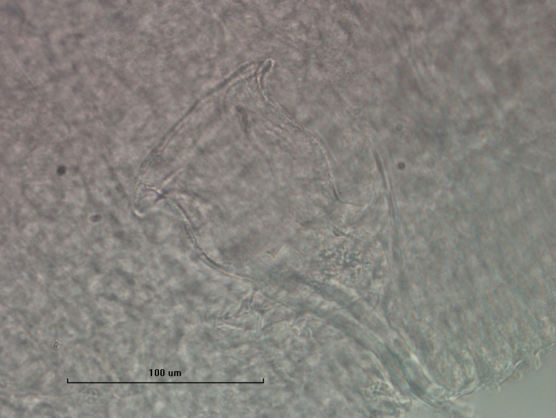 photomicrograph of part of an oligochaete worm showing the vase-shaped reproductive structure called a penis sheath, the surface is granular