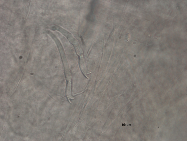 photomicrograph of part of an oligochaete worm showing a bundle of two bifid chaetae (two teeth at the end) with the upper tooth much thinner than the lower tooth and the same length or shorter. Scale bar 100 um.