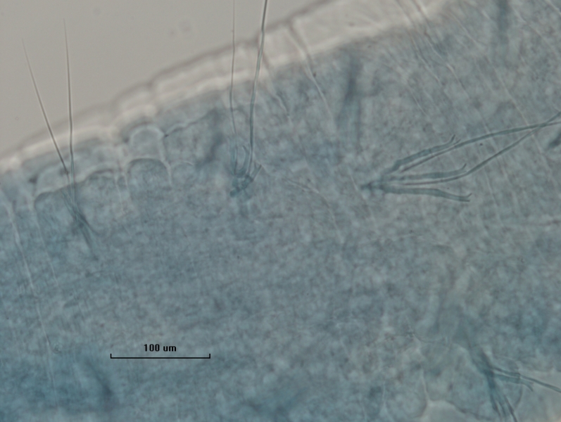 photomicrograph of part of an oligochaete worm showing bundles of a couple hair chaetae with a few pectinate crochet chaetae (bifid ends with thin intermediate teeth)
