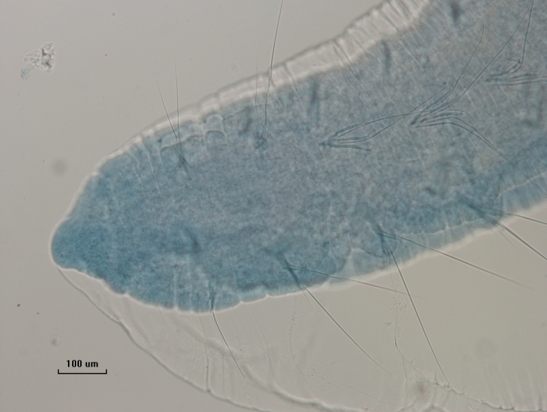photomicrograph of the head of an oligochaete worm with hairs and pectinate chaetae together in bundles