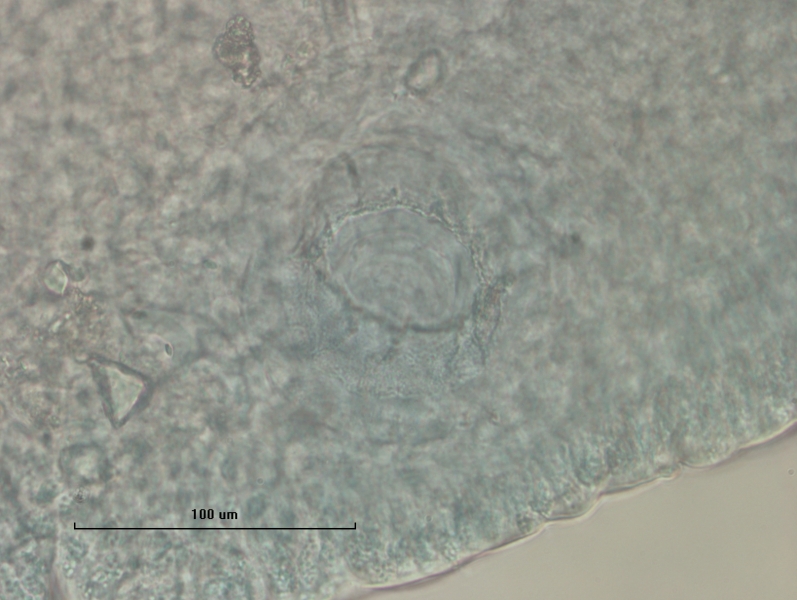 photomicrograph of the reproductive structure of an oligochaete worm, showing an oblique view so the penis sheath looks like a ring with a granular surface on the outside