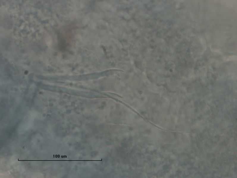 photomicrograph of part of an oligochaete worm showing a bundle with a hair and two pectinate chaetae (bifid ends with thin intermediate teeth)