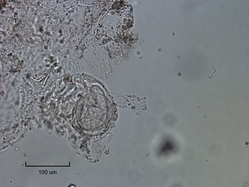 photomicrograph of a damaged oligochaete worm showing some frayed tissue with a round reproductive structure with a granular surface, scale bar 100 um.