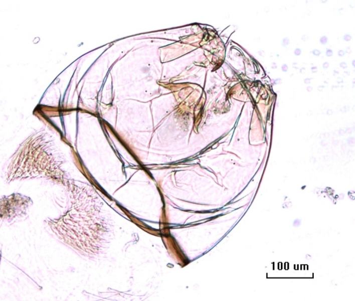 photomicrograph of the head capsule of a chironomid midge larva with retractile antennae, an M appendage, a ligula, and thick mandibles with small apical teeth