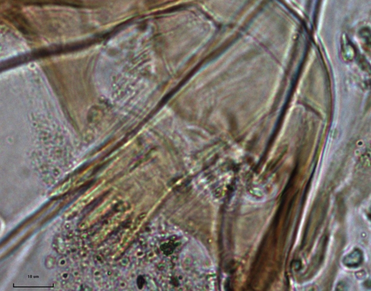 photomicrograph of the closeup of a mouthpart of a chironomid midge larva, the ligula is long and narrow with five even teeth at the end. Very faint paraligula with many teeth a barely distinguishable beside it