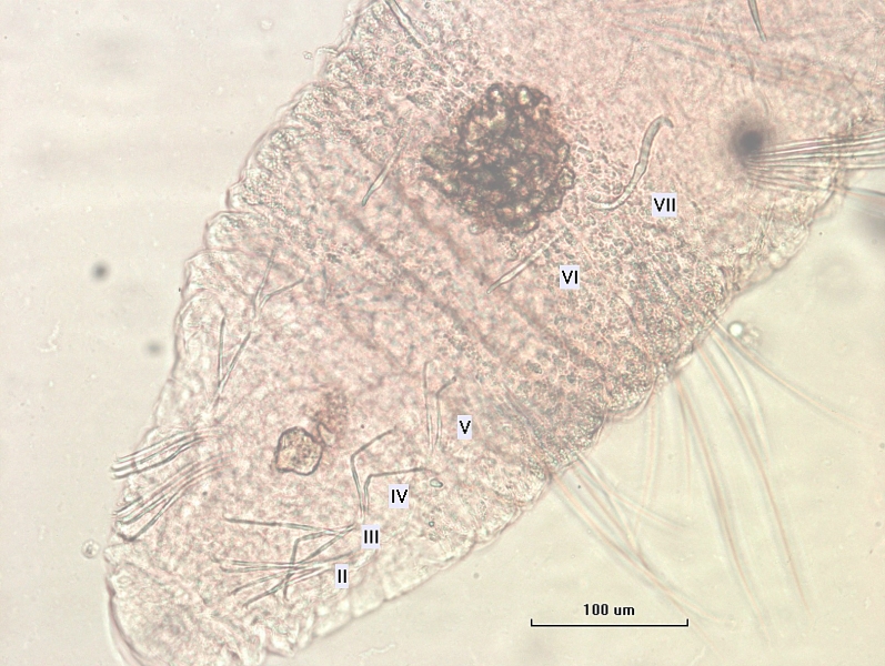 Photomicrograph of an oligochaete worm focusing on the ventral chaetae. The segments are numbered II to VII, and the chaetae change shaped in VI and VII. In VI the skin is thickened into a clitellum with reproductive chaetae, and there are thick, giant chaetae in VII.