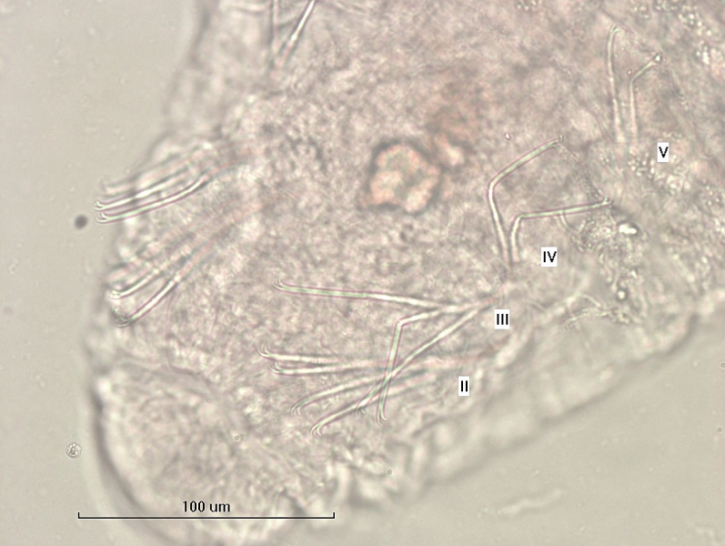 Photomicrograph of an oligochaete worm focusing on the ventral chaetae. The segments are numbered II to V, with the ones in II longest and V shortest.