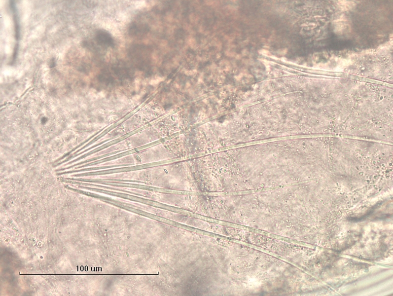 Photomicrograph of the dorsal hairs and needle chaetae of an oligochaete worm splayed in a fan with alternating long hairs and shorter simple pointed needles.