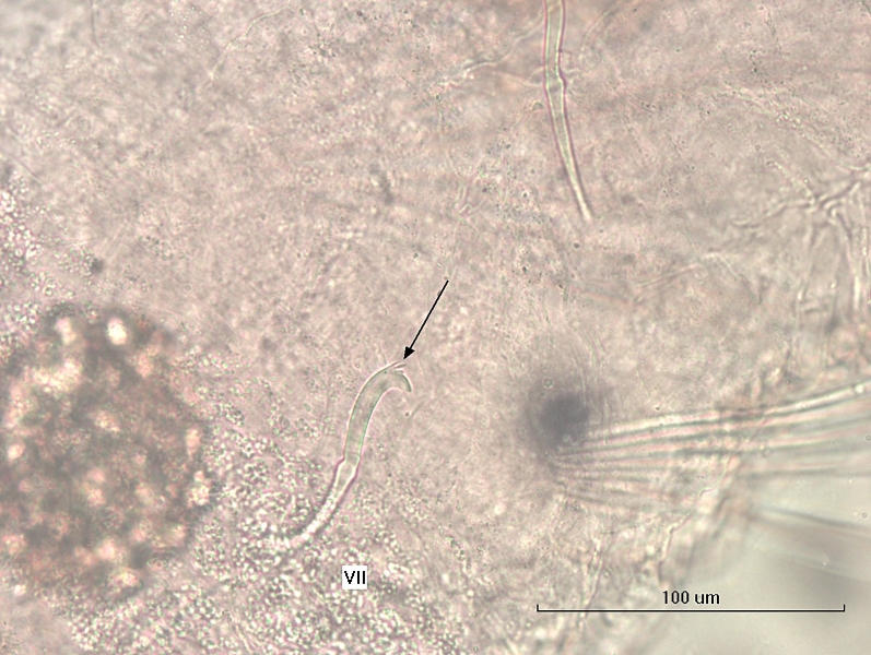 Photomicrograph of a single somatic hair (chaeta) of an oligochaete worm. The chaeta is thick with a thick, recurved lower tooth and several tiny, thin upper teeth. Labeled VII.