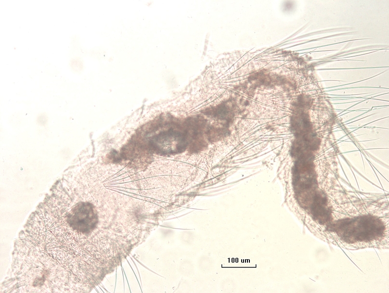 Photomicrograph of an oligochaete worm with many long spiky hairs relative to the short body size