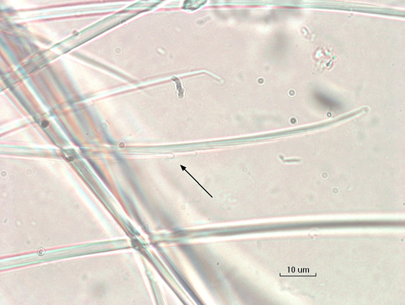 Photomicrograph of a close-up of the hairs of an oligochaete worm showing that the edge of the hair is frayed with thin pieces splitting off, some almost forming loops.