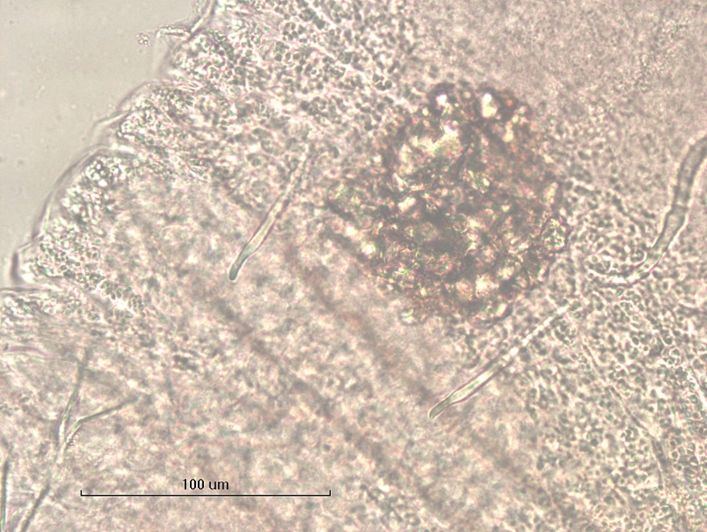 Photomicrograph of part of an oligochaete worm with thickened skin and two thick simple-pointed chaetae.