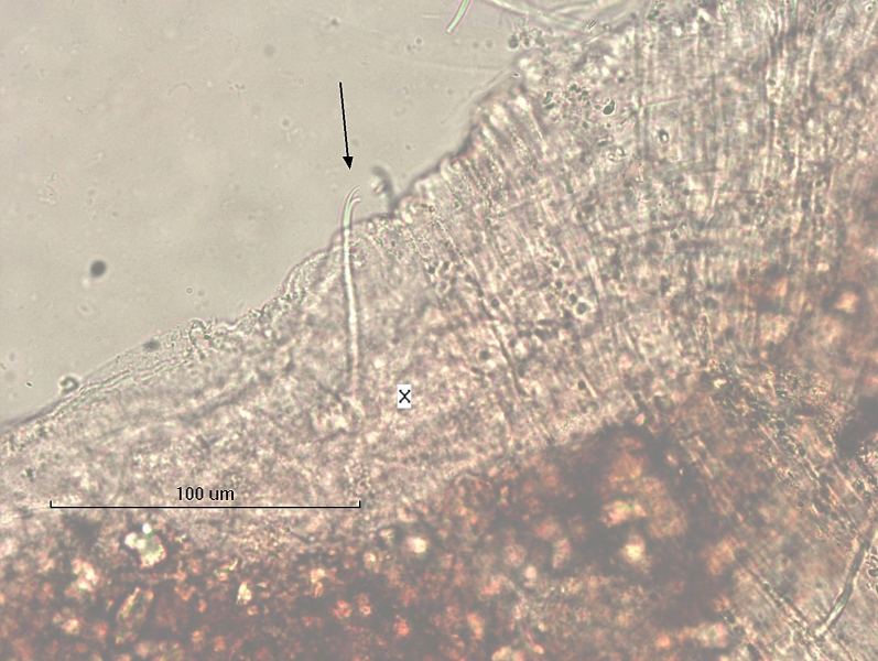 Photomicrograph of a single somatic hair (chaeta) of an oligochaete worm. The chaeta is thin with thin upper and lower teeth. Labeled X.