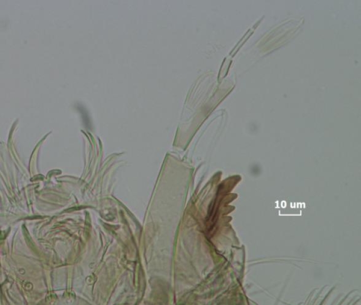 photomicrograph of the antenna of a chironomid midge larva. The antenna has 5 segments. There are two brush-like organs on the second and third segments. Also visible are some of the mouthparts including a mandible.