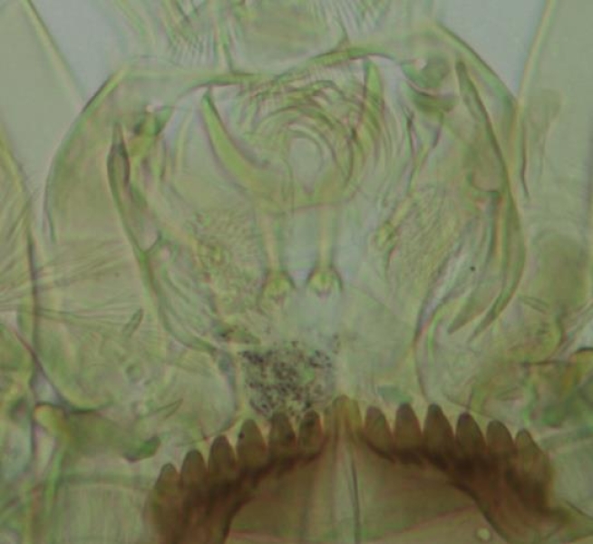 photomicrograph of the mouthparts of a chironomid midge larva including the premandibles (4 teeth) with a brush and the mentum with a central tooth and 6 lateral teeth on either side